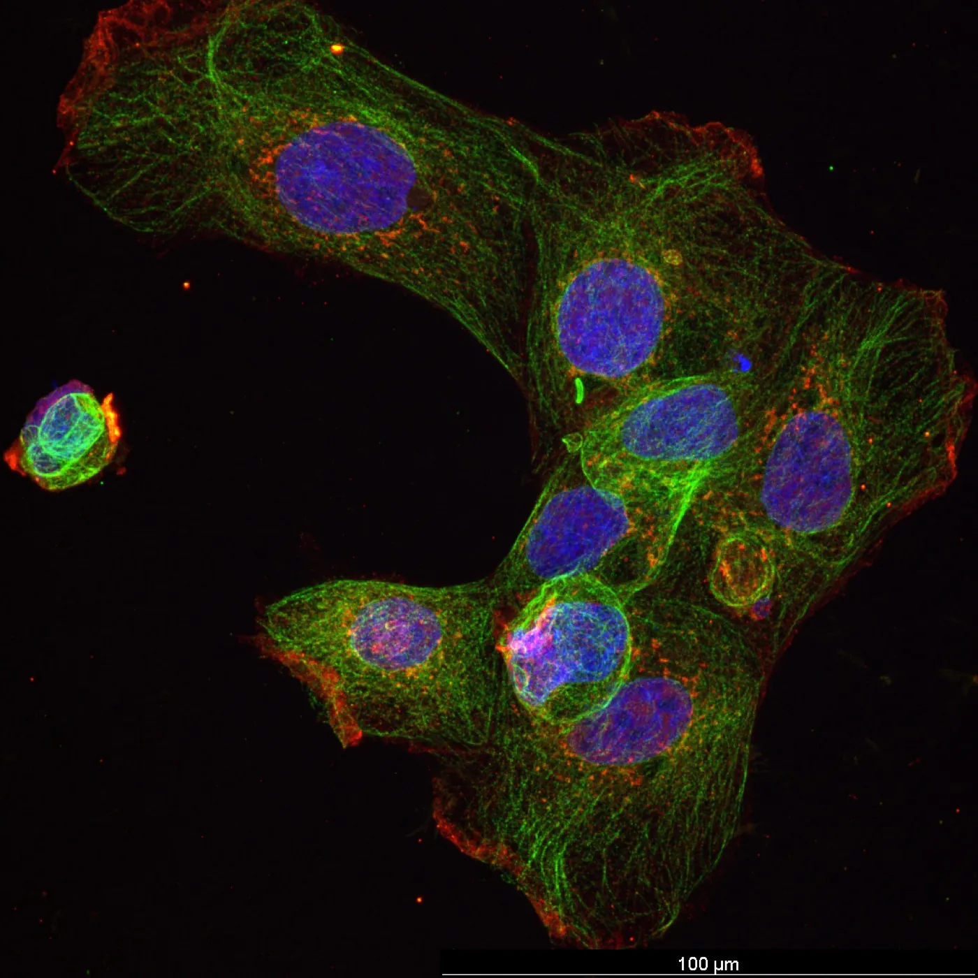 Confocal image of cells exposed to plastic particles
