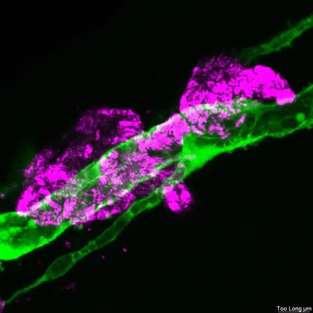 Particles accumulated inside a zebrafish blood vessel